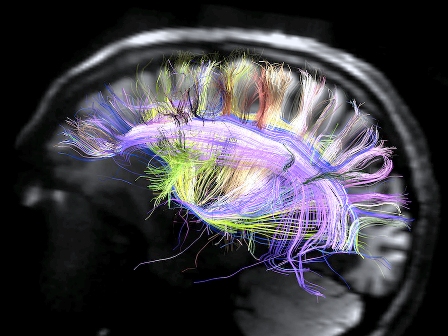 human-brain-120329.jpg