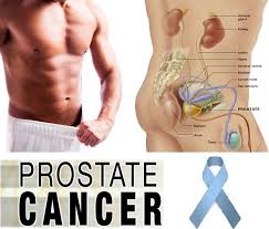 kanker_prostat.jpg