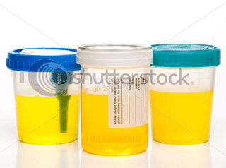 sample-urine.gif