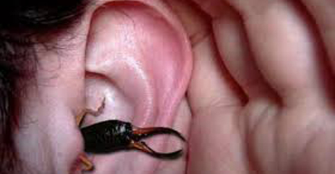 Cara mengeluarkan hewan yang masuk ke telinga